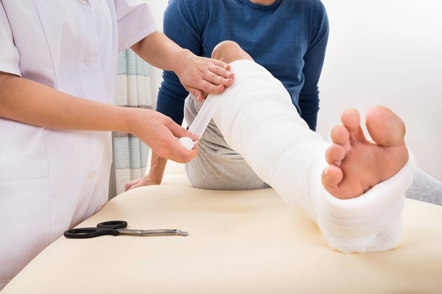 Treating Bone Fractures
